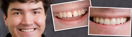 Smile Design and Cosmetic Dentistry