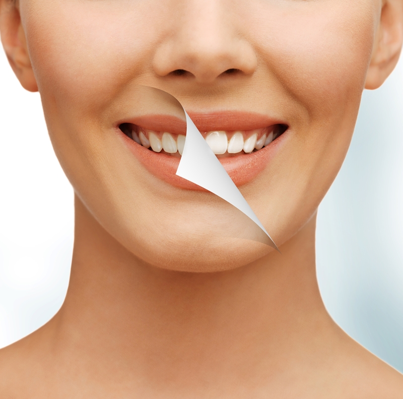 Woman with white teeth and DIY strips treatment