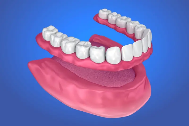 A dental bridge can restore your teeth if you have several adjacent ones missing. 